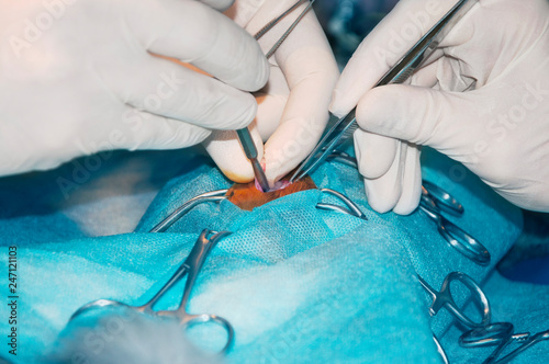 Fragment of surgical operation of ovariectomy (oophorectomy) photo