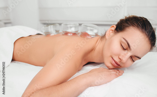 Caucasian woman having traditional chinese treatment, acupuncture cups on female back