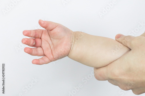 wound burn on child's hand