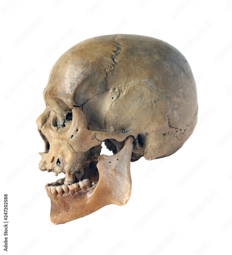 Skull of the person