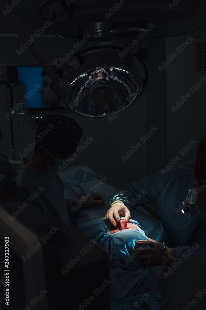 Obraz premium Surgeon and his assistant performing cosmetic surgery on nose