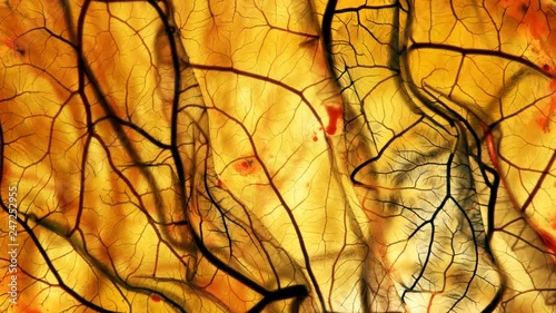 Blood flowing through the blood vessels turns black. It looks like the spread of the virus (coronavirus) in the lung alveoli with pneumonia