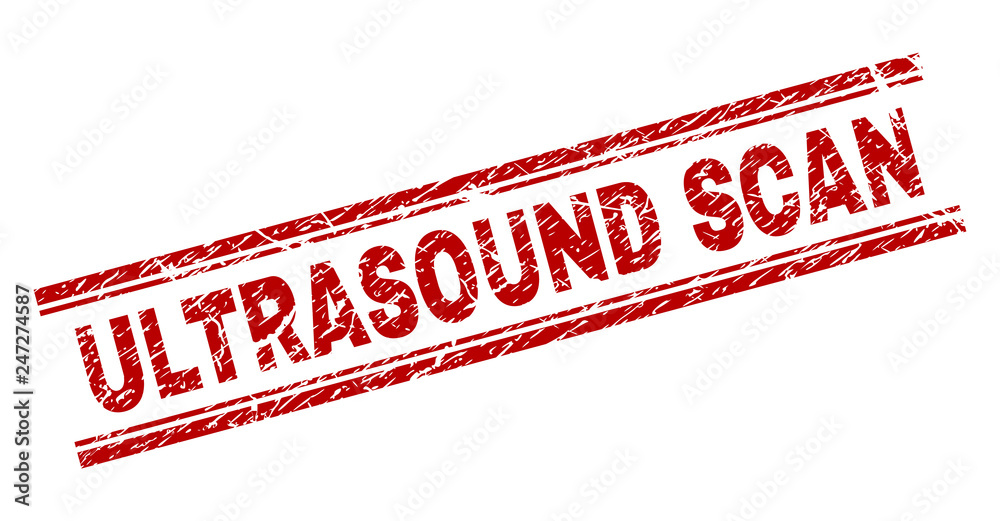 ULTRASOUND SCAN seal watermark with corroded texture. Red vector rubber print of ULTRASOUND SCAN caption with scratched texture. Text caption is placed between double parallel lines. ULTRASOUND SCAN seal watermark with corroded texture. Red vector rubber print of ULTRASOUND SCAN caption with scratched texture. Text caption is placed between double parallel lines.