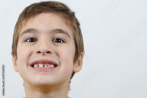 Head Shot Of Little Boy Showing Milk Teeth And Permanent Teeth On White Background