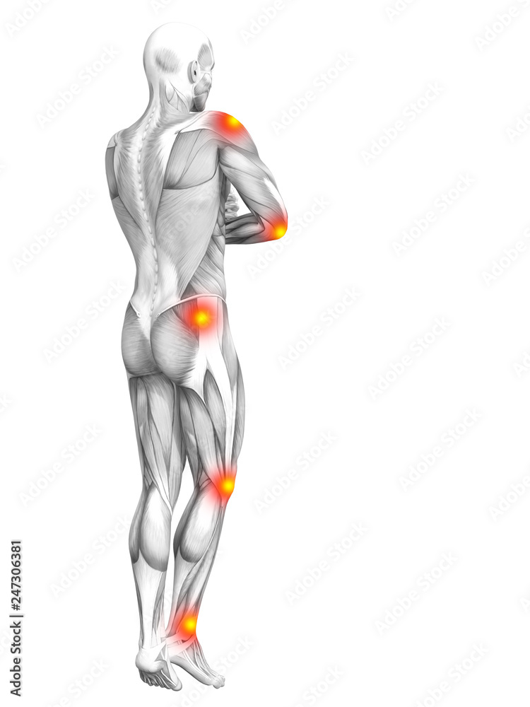 Conceptual human muscle anatomy with red and yellow hot spot inflammation or articular joint pain for health care therapy or sport concepts. 3D illustration man arthritis or bone osteoporosis disease Conceptual human muscle anatomy with red and yellow hot spot inflammation or articular joint pain for health care therapy or sport concepts. 3D illustration man arthritis or bone osteoporosis disease