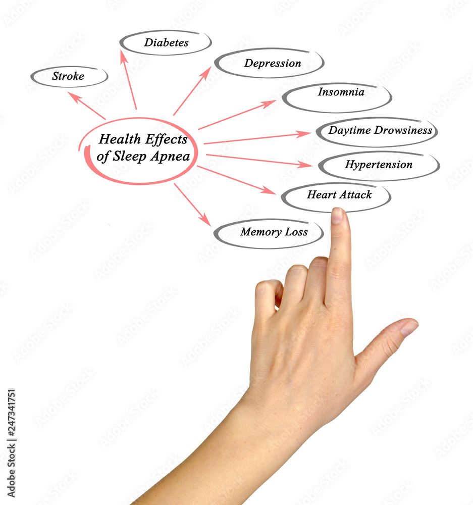 Health Effects of Sleep Apnea Health Effects of Sleep Apnea