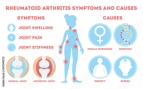 Rheumatism infographic. Bone disease on foot, hand