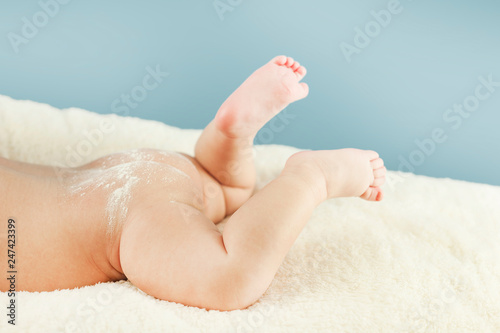 Naked butt of a baby with powdered irritation and prysy at the doctor’s appointment on an isolated blue background. Concept of child