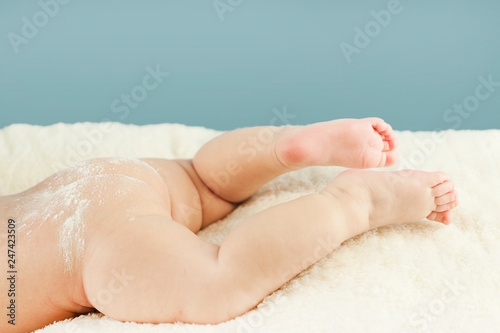 Naked butt of a baby with powdered irritation and prysy at the doctor’s appointment on an isolated blue background. Concept of child