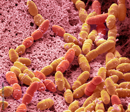 Streptococcus mutans, SEM photo