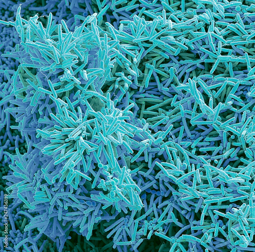 Plaque-forming bacteria, SEM photo