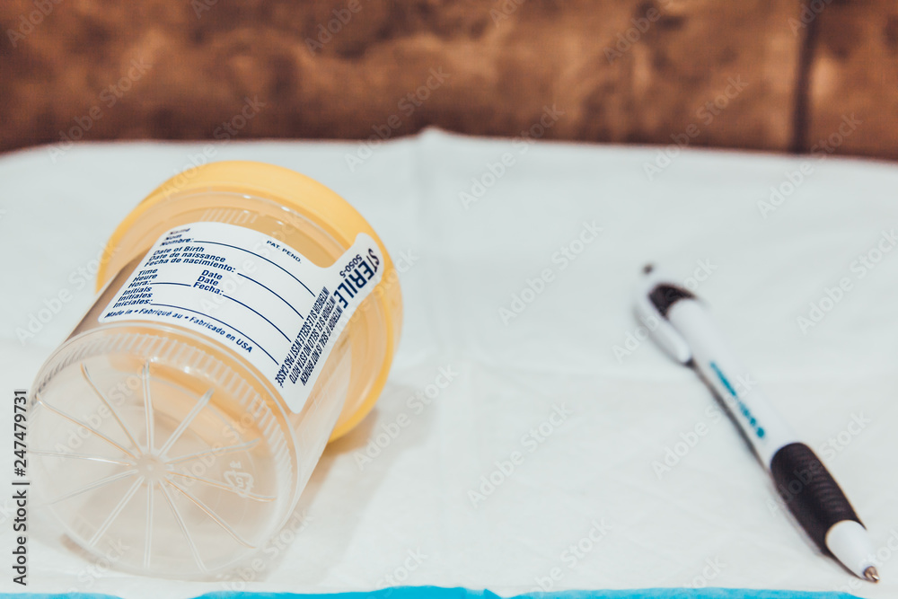 Foto Urine collection cup and pen