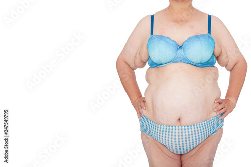 Middle aged woman with excess skin after babies and extreme weight loss. Before brachioplasty, panniculectomy, abdominoplasty and mummy makeover. Full body front view hands on hips, copy space left.