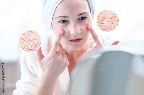 Woman looking at her dry skin with cracks and with first wrinkles. Circles increase the skin like a magnifying magnifier