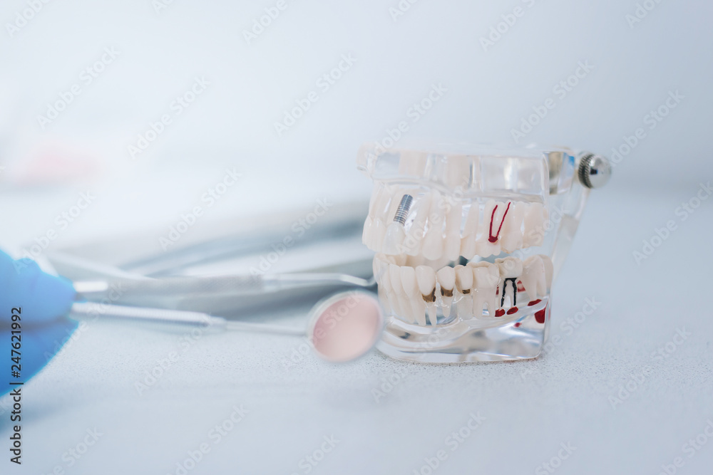 Stomatology. Model of the jaw made of glass. Hand in glove with tools for dentistry. Pulpitis and caries Stomatology. Model of the jaw made of glass. Hand in glove with tools for dentistry. Pulpitis and caries