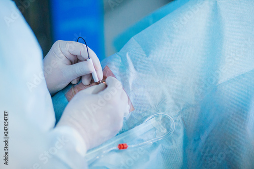Retinal surgery. The doctor in the operating room