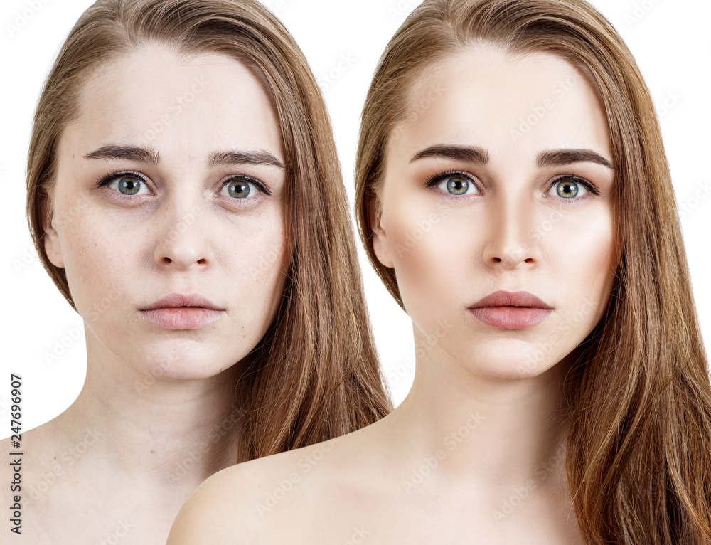 Comparison portrait of young woman before and after retouch. Comparison portrait of young woman before and after retouch.