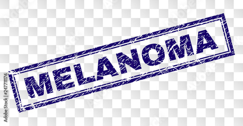 MELANOMA stamp seal print with corroded style and double framed rectangle shape. Stamp is placed on a transparent background. Blue vector rubber print of MELANOMA tag with corroded texture.