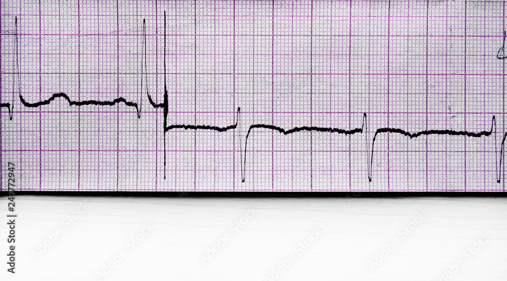 tape with cardiogram graph tape with cardiogram graph