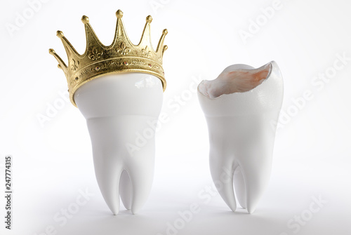 Tooth with a crown - 3D Rendering