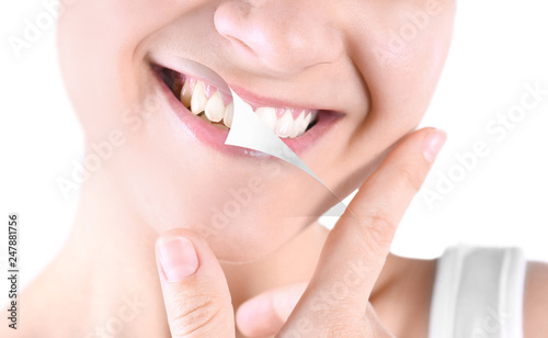 Smiling young woman before and after teeth whitening procedure on light background, closeup