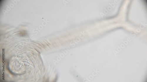 Study Movement and Specimens of Transversotrema patiallensis (parasite) under the microscopic in laboratory. photo