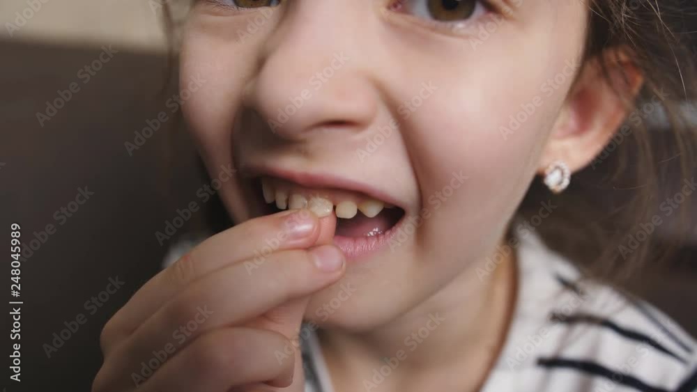 The little girl loosens baby tooth in my mouth that it fell out. The little girl loosens baby tooth in my mouth that it fell out.