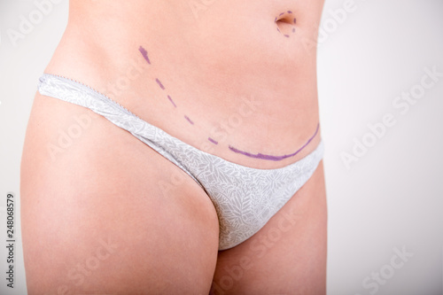 Surgeon drawing marks on female body before plastic operation, white background. Beautician touch and draw correction lines on woman's buttocks.