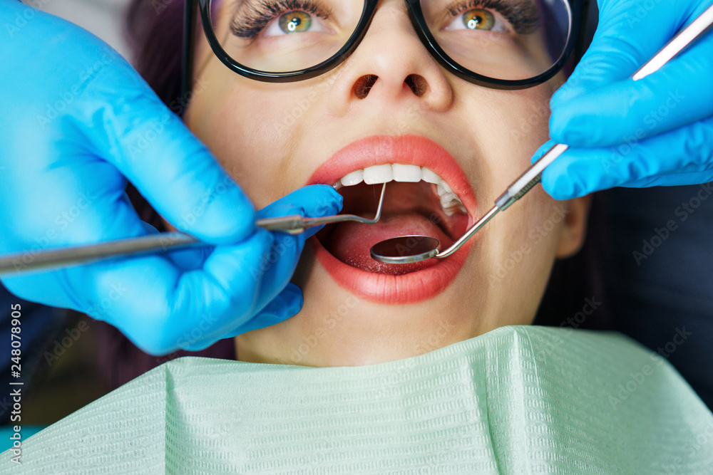 Routine examination at dentist. Young girl with open mouth. White teeth. Hands with medical instrument. Close-up. Routine examination at dentist. Young girl with open mouth. White teeth. Hands with medical instrument. Close-up.