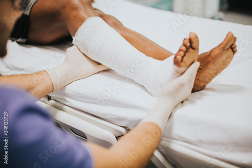 Doctor helping a patient with a fractured leg photo