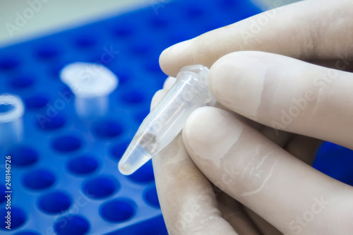 scientist hands in white gloves holding the eppendorf tube with DNA samples  in laboratory. photo