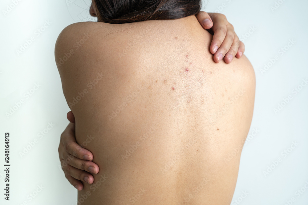 Woman with dermatology skin Dermatologist examining patient Woman with dermatology skin Dermatologist examining patient
