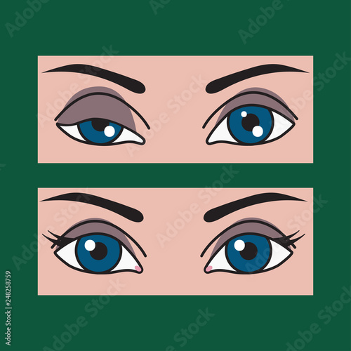 Ptosis, asymmetry of eyes