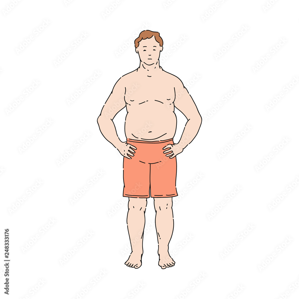 Fototapeta premium Vector flat overweight obese unhappy man topless