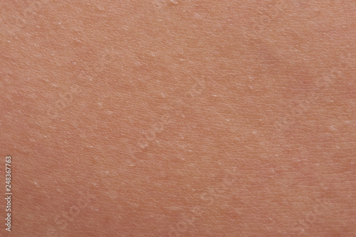 Texture background of flat human skin