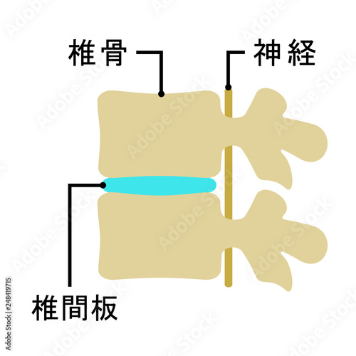 椎間板の図 photo