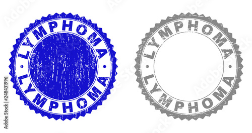 Grunge LYMPHOMA watermarks isolated on a white background. Rosette seals with grunge texture in blue and grey colors. Vector rubber stamp imprint of LYMPHOMA label inside round rosette.