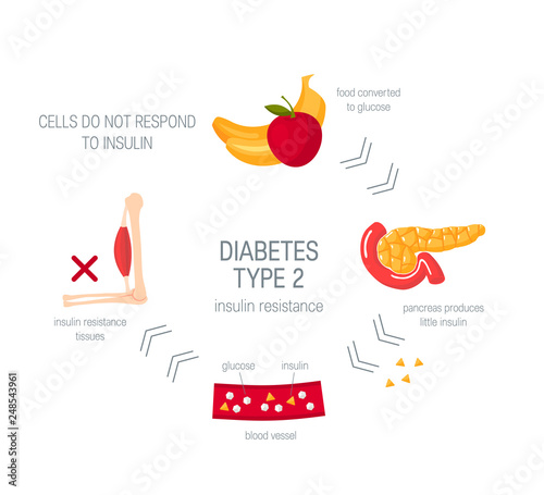 Diabetes type 2 concept in flat style, vector