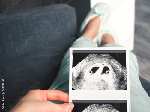 The girl is holding a snapshot of an ultrasound twin in the fourth week of pregnancy. First trimester. Selective focus.