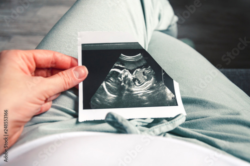 A girl holds a picture of an ultrasound baby in her twentieth week of pregnancy. Second trimester Selective focus.