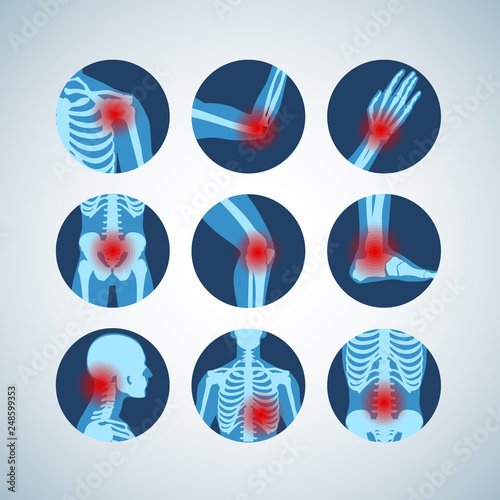 Rheumatism or rheumatic disorder medical set. Arthritis joint pain syndrome. Different body parts with pain rings on hand, leg and feet, spine, scull, pelvis. Rheumatology vector infographics elements