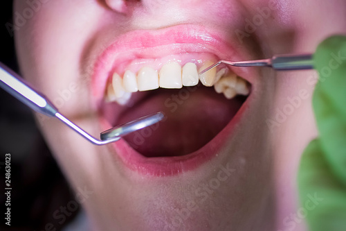 Treatment of sick teeth at the dentist.