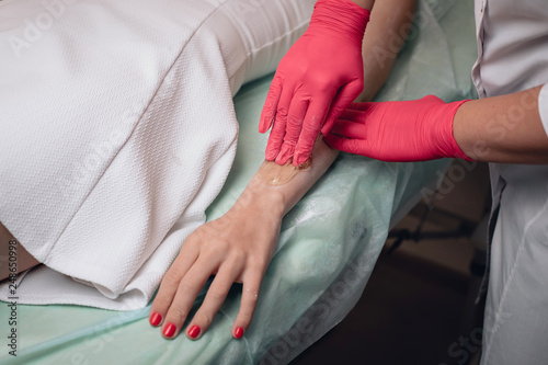 Beautician removes hair from a woman s hand. Sugaring. Hair removal with a special sugar paste has many advantages over wax depilation.close up photo