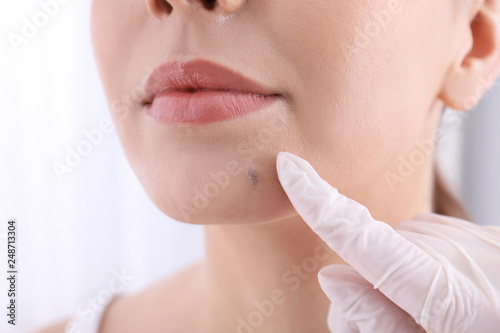 Dermatologist examining patient in clinic, closeup view