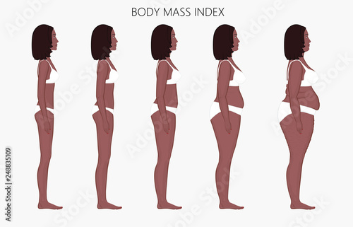 Vector illustration body mass Index African American woman from lack of weight to obesity Side view. For advertising of cosmetic plastic procedures, stomach shunting, diet, medical publications