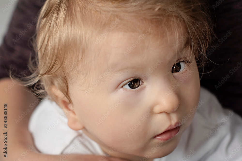 cute baby one year old happy disabled child portrait close-up - image cute baby one year old happy disabled child portrait close-up - image