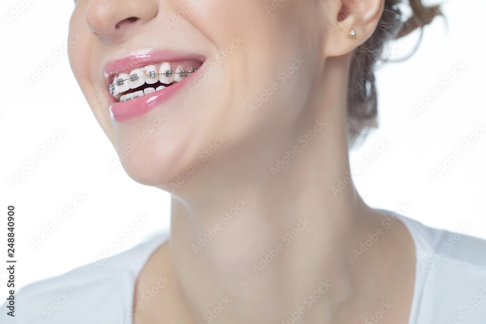 Woman with braces Woman with braces