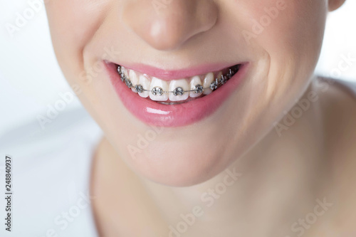 Woman with braces 