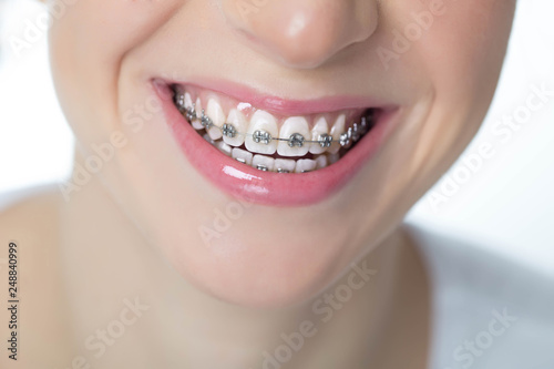 Woman with braces