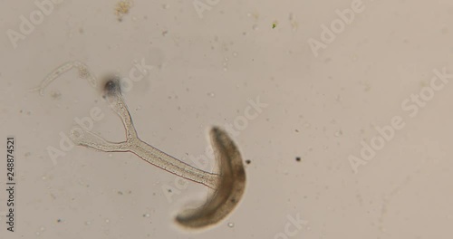Study Movement and Specimens of Transversotrema patiallensis (parasite) under the microscopic in laboratory. photo